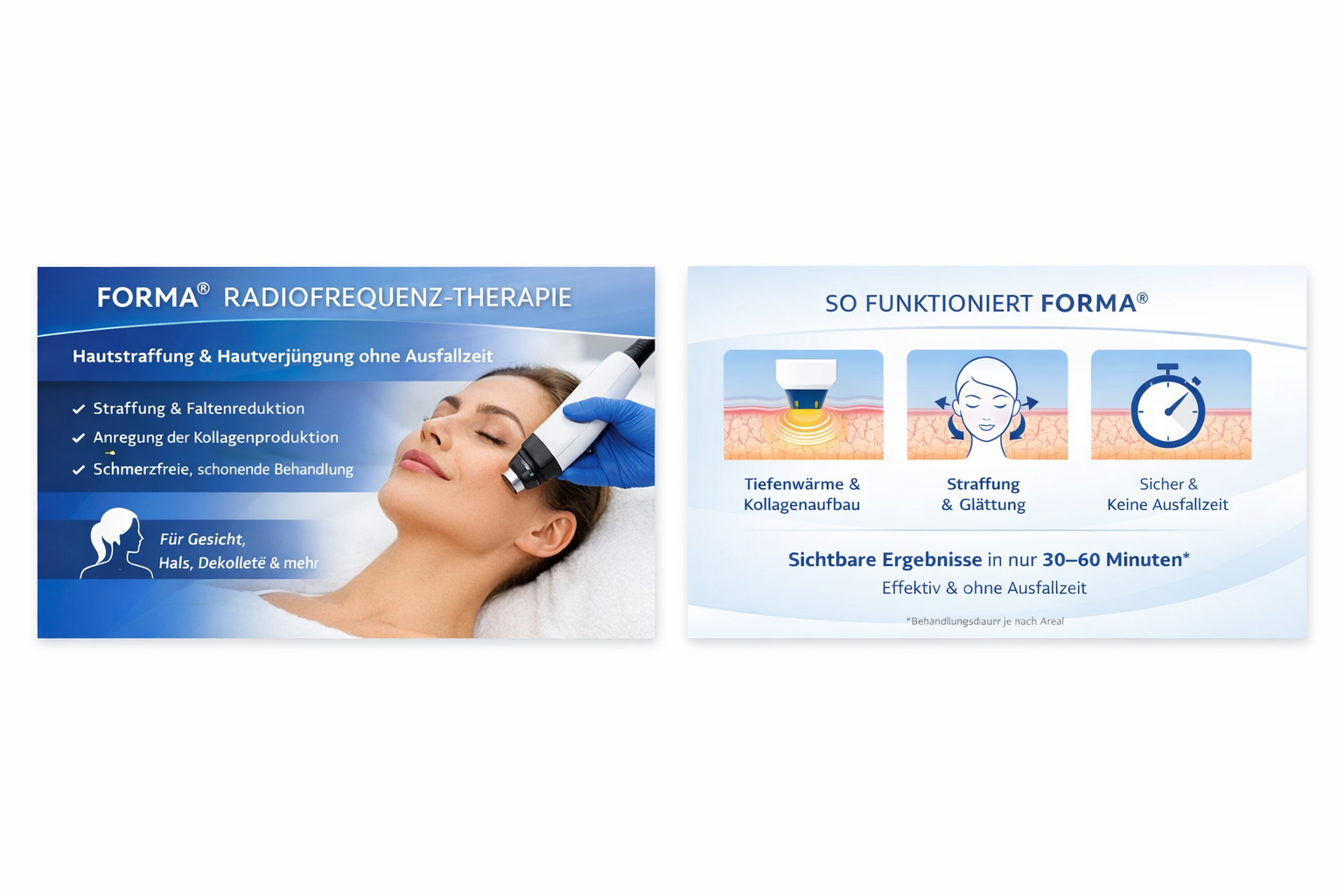 Radiofrequenz-Therapie Forma®